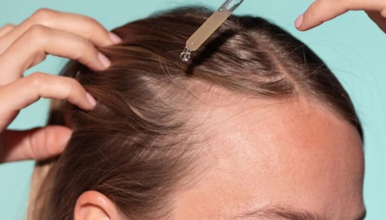 Des cheveux épais et sains avec le traitement anti-chute le plus viral de ces dernières années (que vous pouvez acheter sur Amazon)